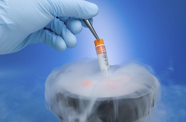 Cryo Tweezers - Image 2